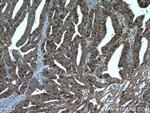 Thymidylate synthase Antibody in Immunohistochemistry (Paraffin) (IHC (P))