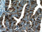 Thymidylate synthase Antibody in Immunohistochemistry (Paraffin) (IHC (P))