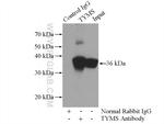 Thymidylate synthase Antibody in Immunoprecipitation (IP)