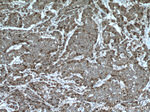 Thymidylate synthase Antibody in Immunohistochemistry (Paraffin) (IHC (P))