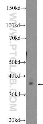 Thymidylate synthase Antibody in Western Blot (WB)