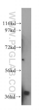 NAGK Antibody in Western Blot (WB)