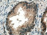 SMOX Antibody in Immunohistochemistry (Paraffin) (IHC (P))