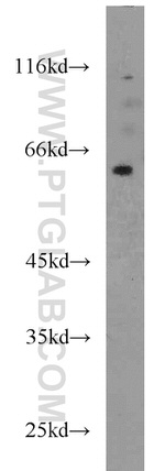 SMOX Antibody in Western Blot (WB)