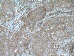 ARPC2 Antibody in Immunohistochemistry (Paraffin) (IHC (P))