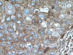 ARPC2 Antibody in Immunohistochemistry (Paraffin) (IHC (P))