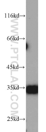 ARPC2 Antibody in Western Blot (WB)