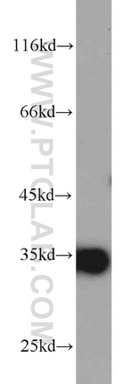 ARPC2 Antibody in Western Blot (WB)