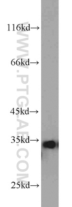 ARPC2 Antibody in Western Blot (WB)