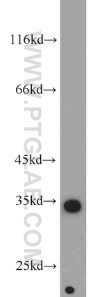 ARPC2 Antibody in Western Blot (WB)