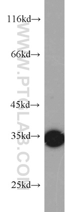 ARPC2 Antibody in Western Blot (WB)