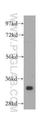 ARPC2 Antibody in Western Blot (WB)