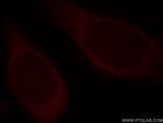 HPRT1 Antibody in Immunocytochemistry (ICC/IF)