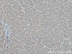 HPRT1 Antibody in Immunohistochemistry (Paraffin) (IHC (P))