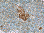 HPRT1 Antibody in Immunohistochemistry (Paraffin) (IHC (P))