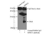 HPRT1 Antibody in Immunoprecipitation (IP)