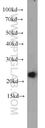 HPRT1 Antibody in Western Blot (WB)