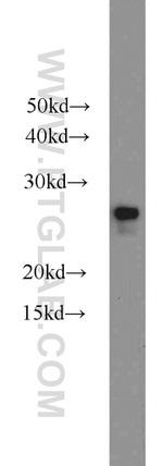 HPRT1 Antibody in Western Blot (WB)