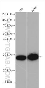 HPRT1 Antibody in Western Blot (WB)