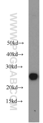 HPRT1 Antibody in Western Blot (WB)