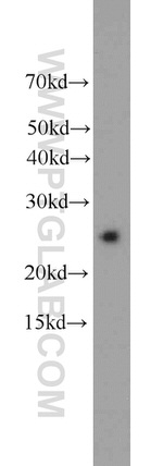 HPRT1 Antibody in Western Blot (WB)