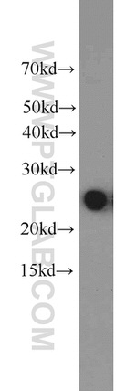 HPRT1 Antibody in Western Blot (WB)