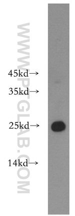 HPRT1 Antibody in Western Blot (WB)