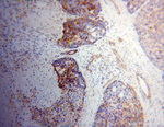 NDUFS3 Antibody in Immunohistochemistry (Paraffin) (IHC (P))