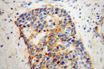 NDUFS3 Antibody in Immunohistochemistry (Paraffin) (IHC (P))