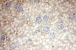 NDUFS3 Antibody in Immunohistochemistry (Paraffin) (IHC (P))