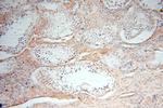 NDUFS3 Antibody in Immunohistochemistry (Paraffin) (IHC (P))