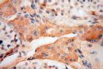 NDUFS3 Antibody in Immunohistochemistry (Paraffin) (IHC (P))