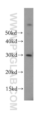 NDUFS3 Antibody in Western Blot (WB)