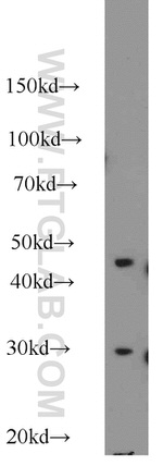 NDUFS3 Antibody in Western Blot (WB)