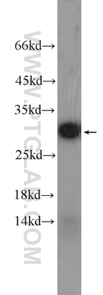 NDUFS3 Antibody in Western Blot (WB)