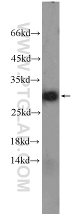 NDUFS3 Antibody in Western Blot (WB)