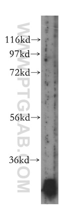 NDUFS3 Antibody in Western Blot (WB)