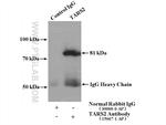 TARS2 Antibody in Immunoprecipitation (IP)