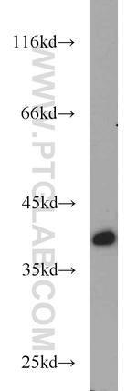 NUDT9 Antibody in Western Blot (WB)