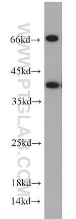 NUDT9 Antibody in Western Blot (WB)