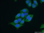 PCBP2 Antibody in Immunocytochemistry (ICC/IF)