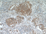 PCBP2 Antibody in Immunohistochemistry (Paraffin) (IHC (P))