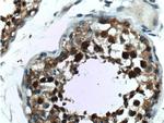 PCBP2 Antibody in Immunohistochemistry (Paraffin) (IHC (P))