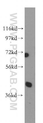 PCBP2 Antibody in Western Blot (WB)