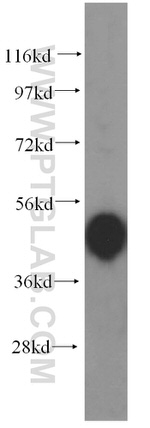 PCBP2 Antibody in Western Blot (WB)