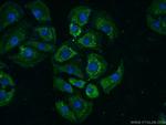 TTBK2 Antibody in Immunocytochemistry (ICC/IF)