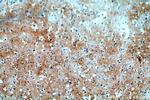 TTBK2 Antibody in Immunohistochemistry (Paraffin) (IHC (P))