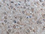 TTBK2 Antibody in Immunohistochemistry (Paraffin) (IHC (P))