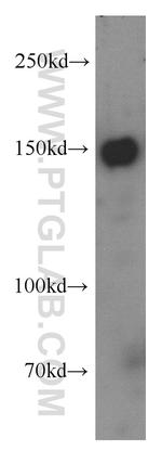 TTBK2 Antibody in Western Blot (WB)