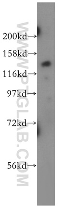 TTBK2 Antibody in Western Blot (WB)